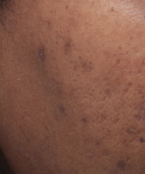 Cashmere Peel Gentle Exfoliating Aha + Pha Toner