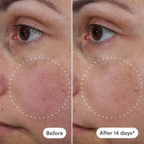 Azelaic Exosome + Vitamin C Serum - Naked Ambition