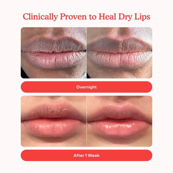 Lip Softie Hydrating Tinted Lip Treatment Balm