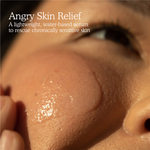 SOS Intensive Redness Relief Serum with Hypochlorous Acid - GLAM MODA