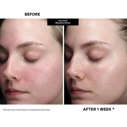 DeliKate Recovery Serum 30ml - GLAM MODA