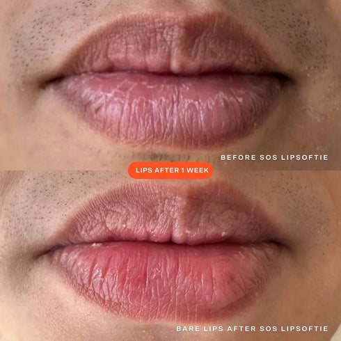 SOS Lip Softie Rescue lip treatment - GLAM MODA
