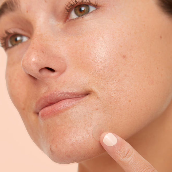 Acne Dots - Acne Healing Dots