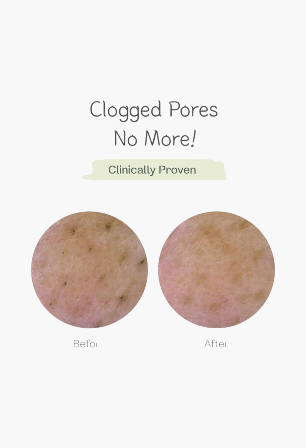 Deep Pore Cleansing Soda Foam - GLAM MODA