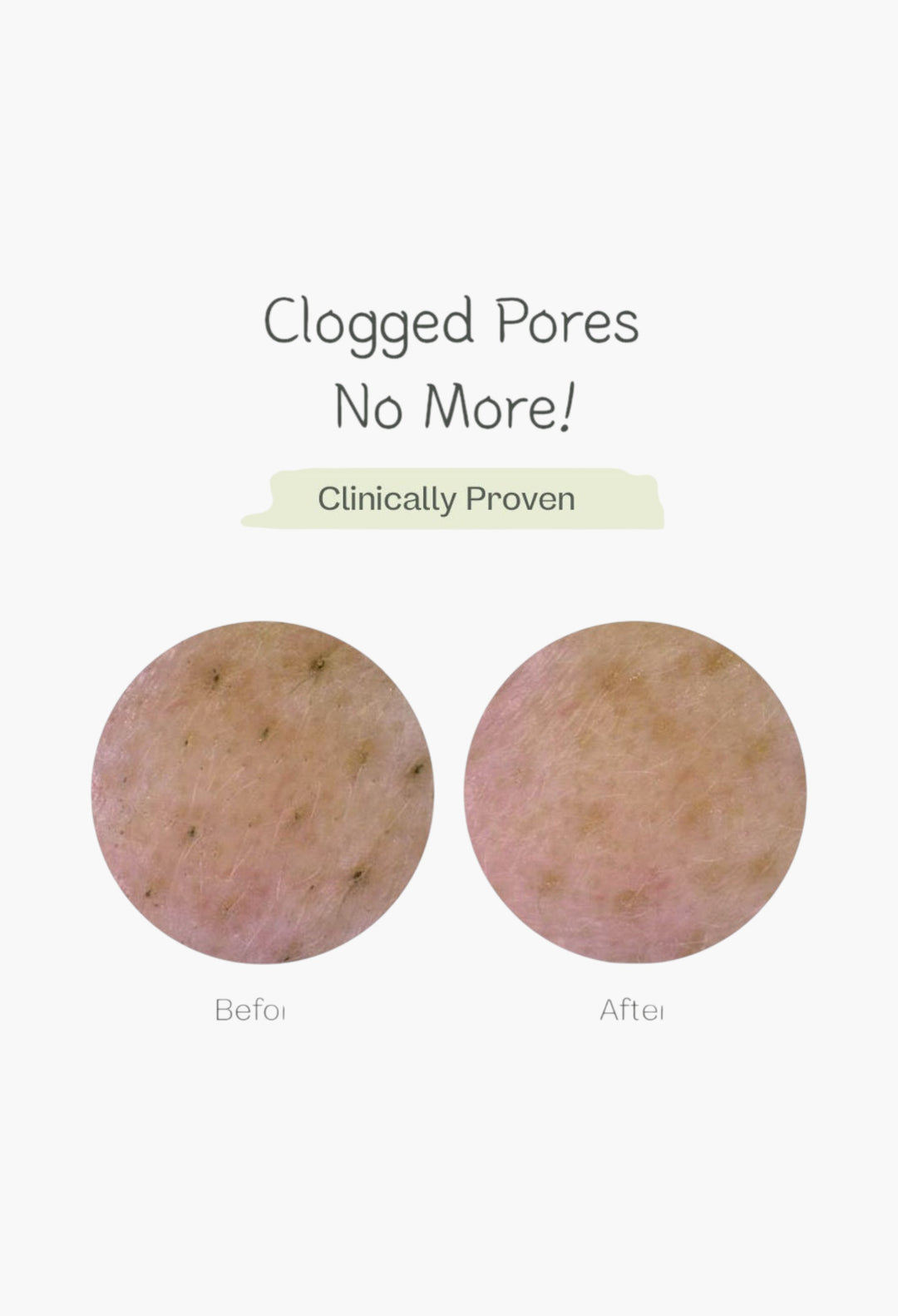 Deep Pore Cleansing Soda Foam - GLAM MODA