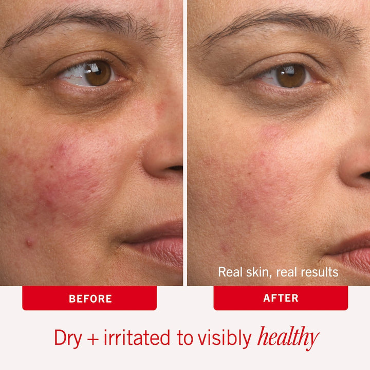 Ultra Repair® Cream Intense Hydration – Face and Body Moisturizer for Skin Repair - GLAM MODA