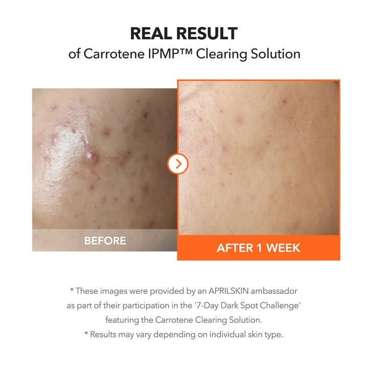 Carrotene IPMP™ Clearing Solution - GLAM MODA