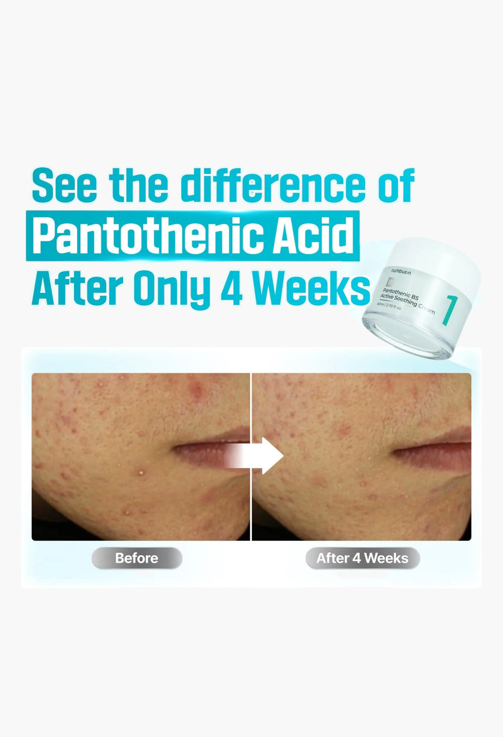 No.1 Pantothenic B5 Active Soothing Cream - GLAM MODA
