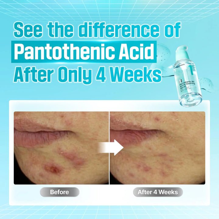 No.1 Pantothenic B5 Active Soothing Serum - GLAM MODA