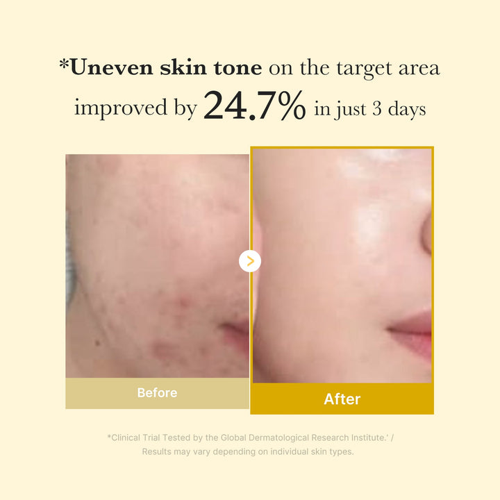 Kojic Acid Turmeric Overnight Wrapping Mask - GLAM MODA
