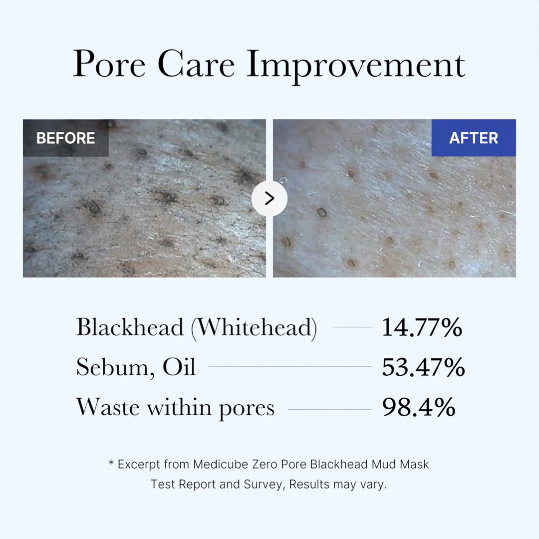 Zero Pore Blackhead Mud Mask - GLAM MODA