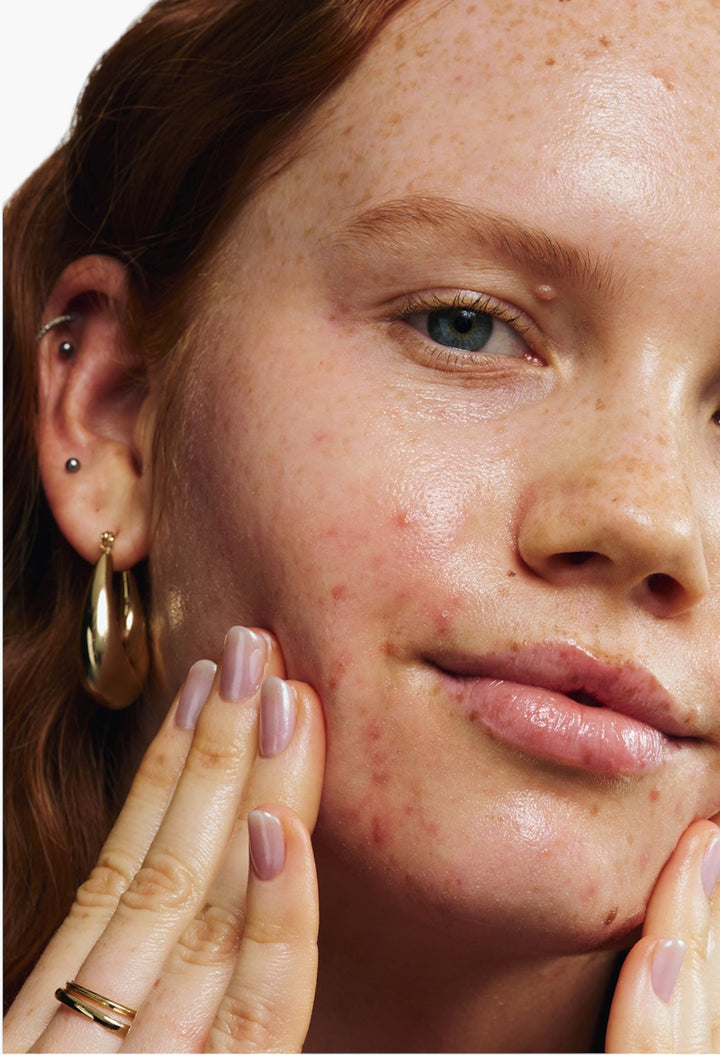 Dew More - Barrier-Boosting Moisturizer - GLAM MODA