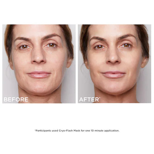Cryo-Flash Instant Lift Effect & Glow Boosting Face Mask - GLAM MODA