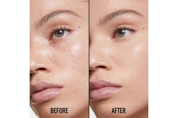 Forever Skin Correct