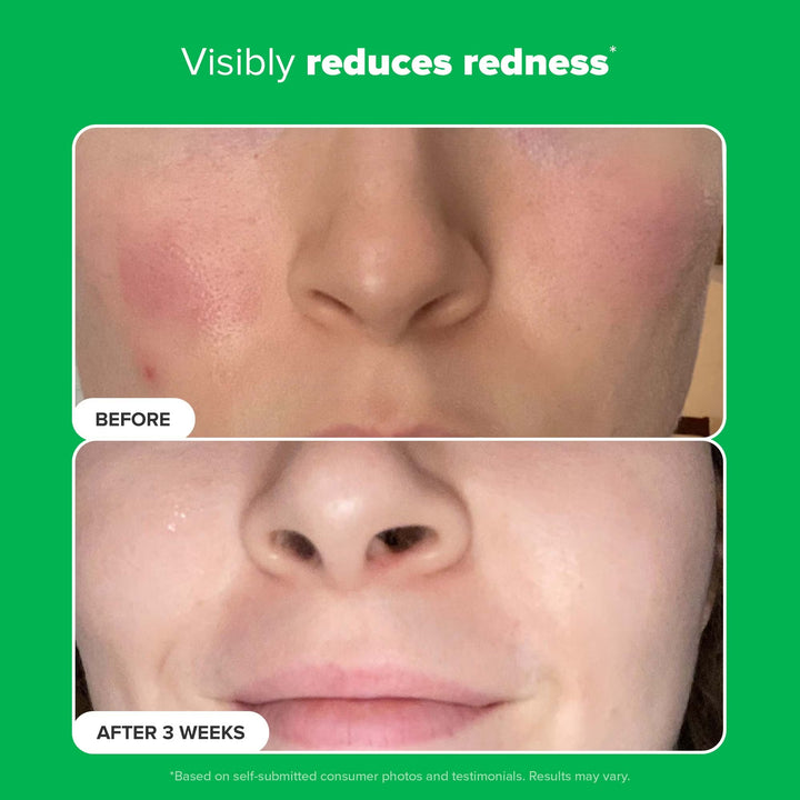 10% Azelaic Acid Booster 30ml - GLAM MODA