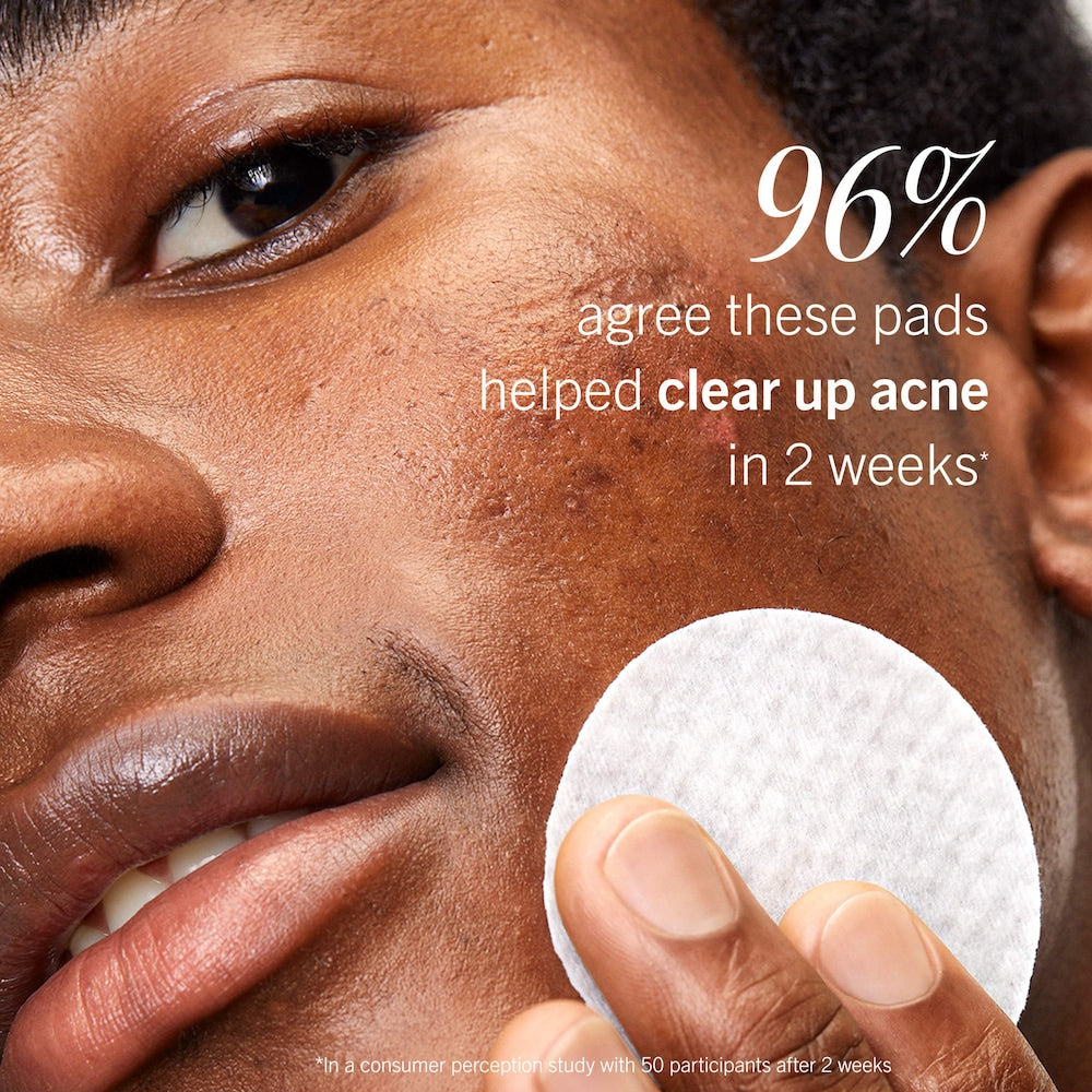 Acne Clearing Pads - 2% Salicylic Acid Acne Treatment - GLAM MODA
