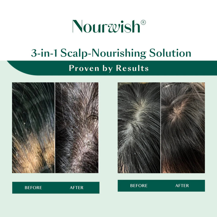 Nourwish Scalp Retreat Nourishing Scalp Serum - GLAM MODA