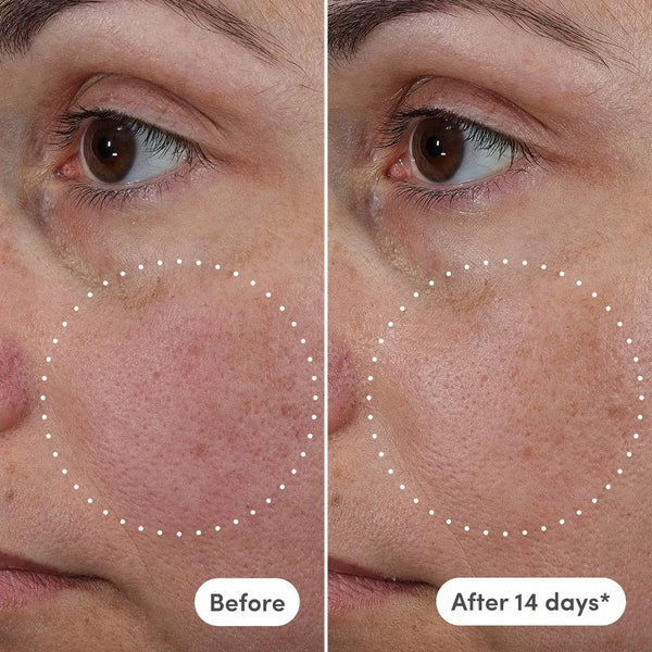 Azelaic Exosome + Vitamin C Serum - Naked Ambition