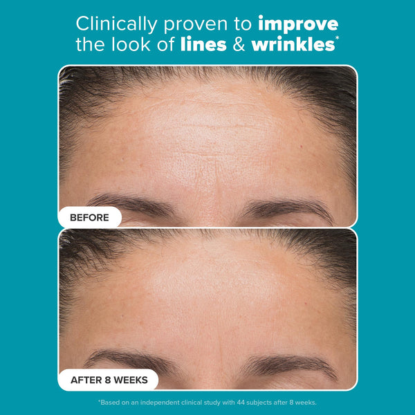 Perfecting 6% Mandelic Acid and 2% Lactic Acid Liquid Exfoliant 88ml