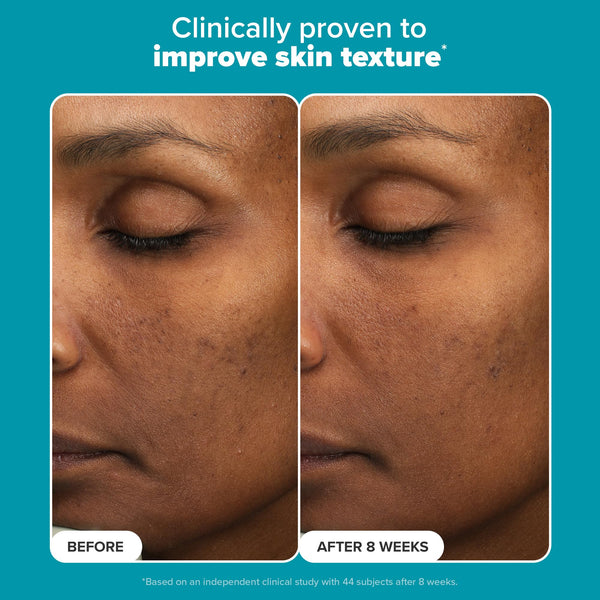 Perfecting 6% Mandelic Acid and 2% Lactic Acid Liquid Exfoliant 88ml