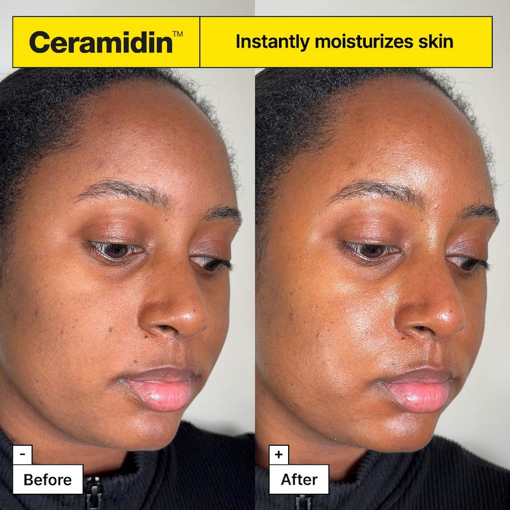 Ceramidin™ Skin Barrier Moisturizing Cream - GLAM MODA