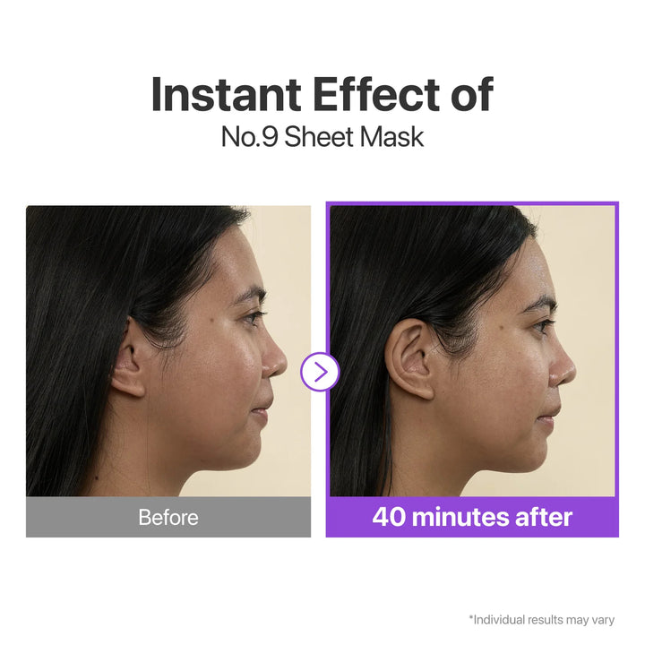 No.9 NAD+ BIO Lifting-Sil Full Face Mask (4 Sheets + Lifting Band) - GLAM MODA