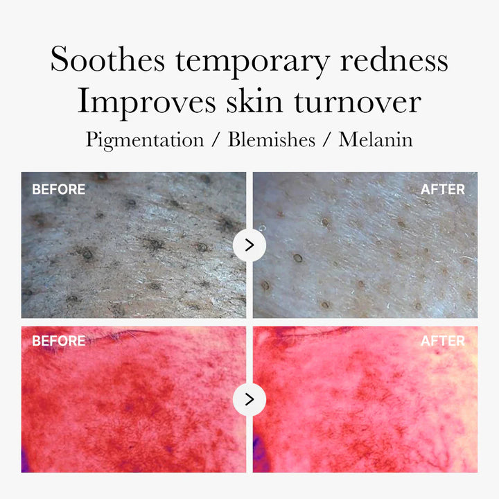 Red Succinic Acid - GLAM MODA