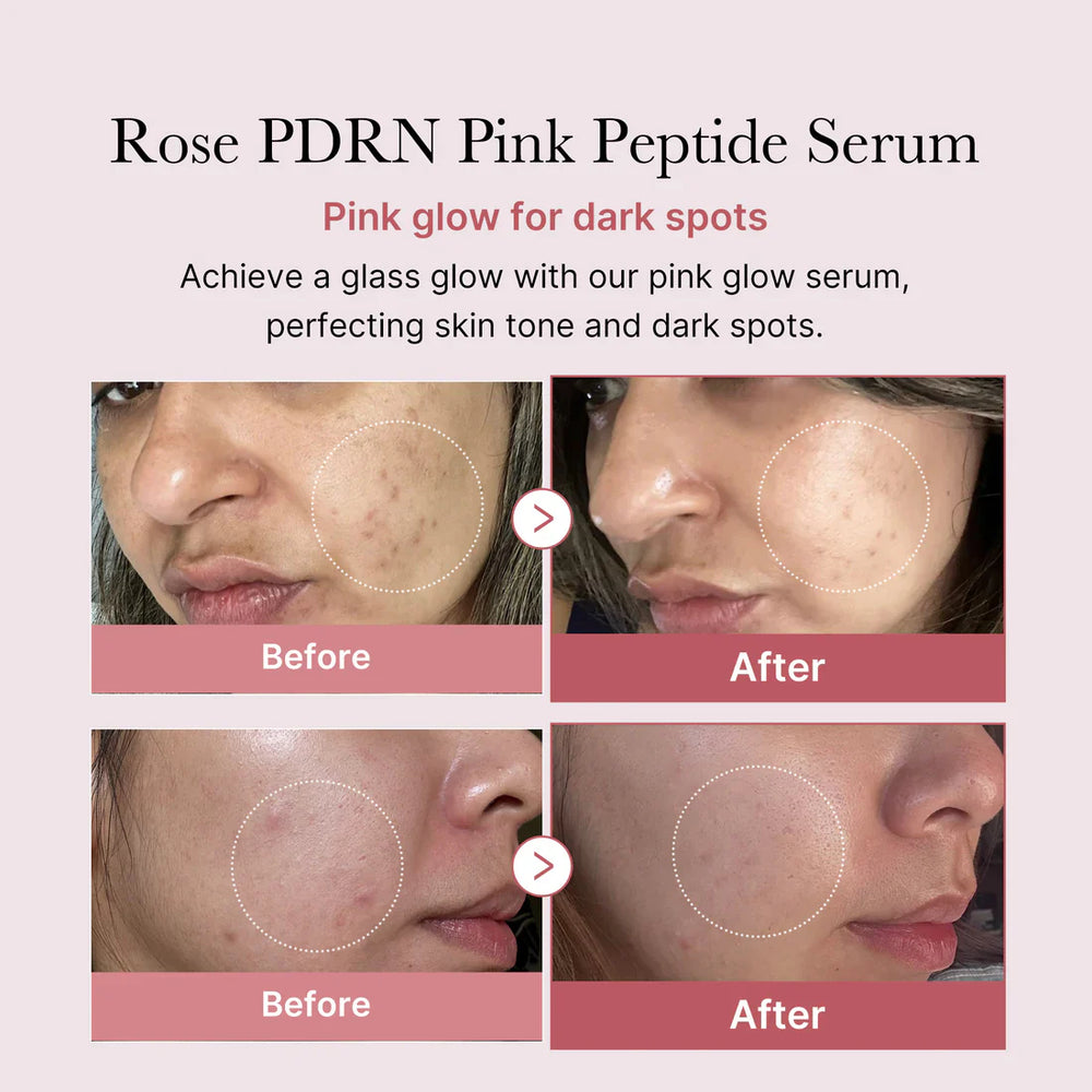 PDRN Pink Peptide Serum - GLAM MODA