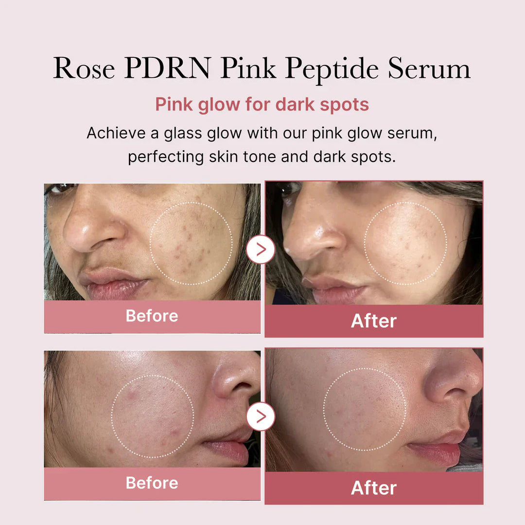 PDRN Pink Peptide Serum - GLAM MODA