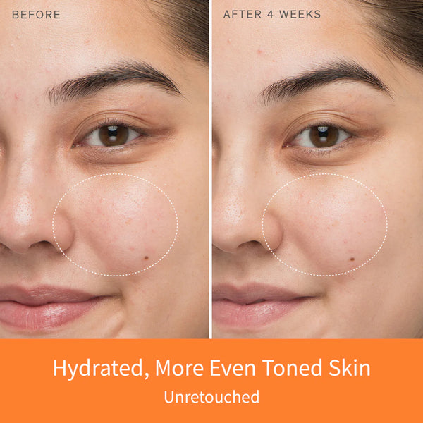 First Care Activating Serum VI