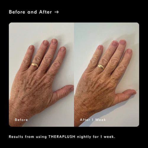 Theraplush “Hold” Refillable Overnight Retinol Hand Repair Cream - GLAM MODA