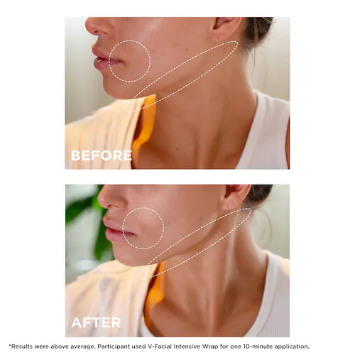 V-Facial Instant Depuffing Face Mask - GLAM MODA