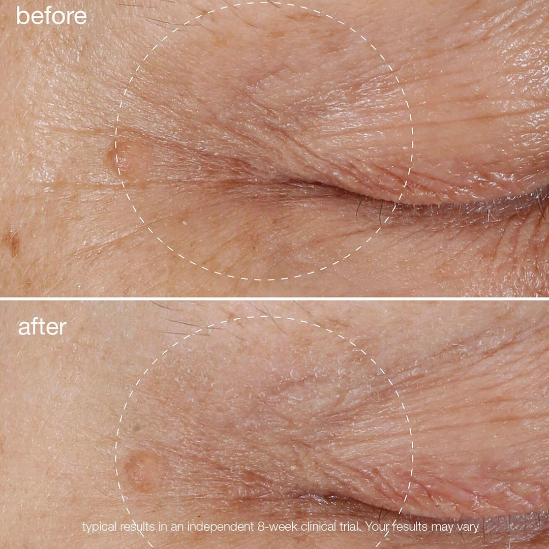 Biolumin-C Vitamin C Eye Serum - GLAM MODA