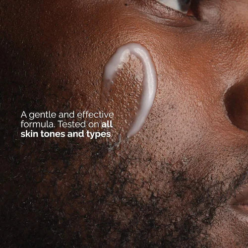Niacinamide 5% Face and Body Emulsion for Dark Spots & Uneven Tone