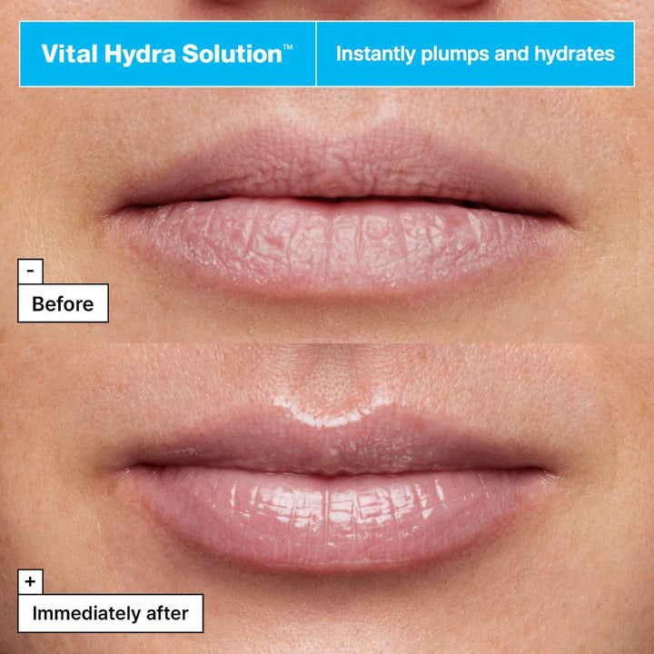 Vital Hydra Solution™ Jelly Bear Lip Mask with Hyaluronic Acid - GLAM MODA