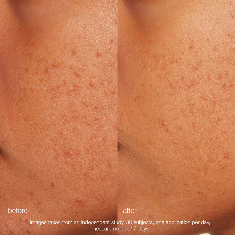 Daily Microfoliant Exfoliator - GLAM MODA