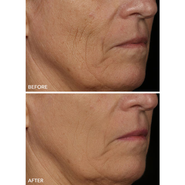Spectralite FaceWare Pro