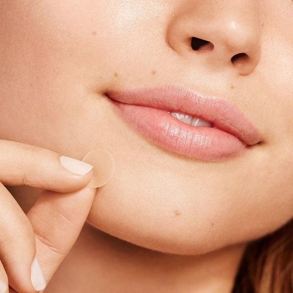 Acne Dots - Acne Healing Dots