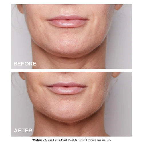 Cryo-Flash Instant Lift Effect & Glow Boosting Face Mask - GLAM MODA