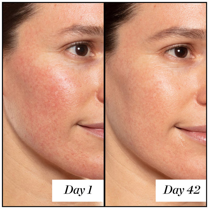 A+ High-Dose Retinoid Serum - GLAM MODA