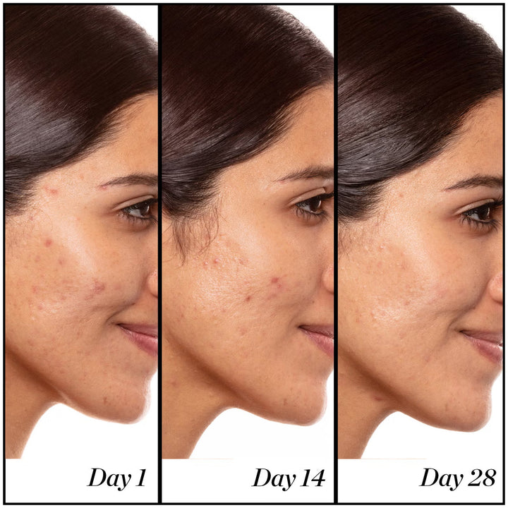 A+ High-Dose Retinoid Serum - GLAM MODA