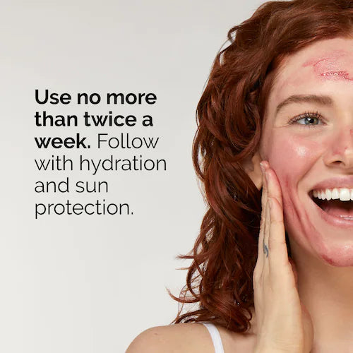 AHA 30% + BHA 2% High-Strength Peeling Solution for Brightening - GLAM MODA