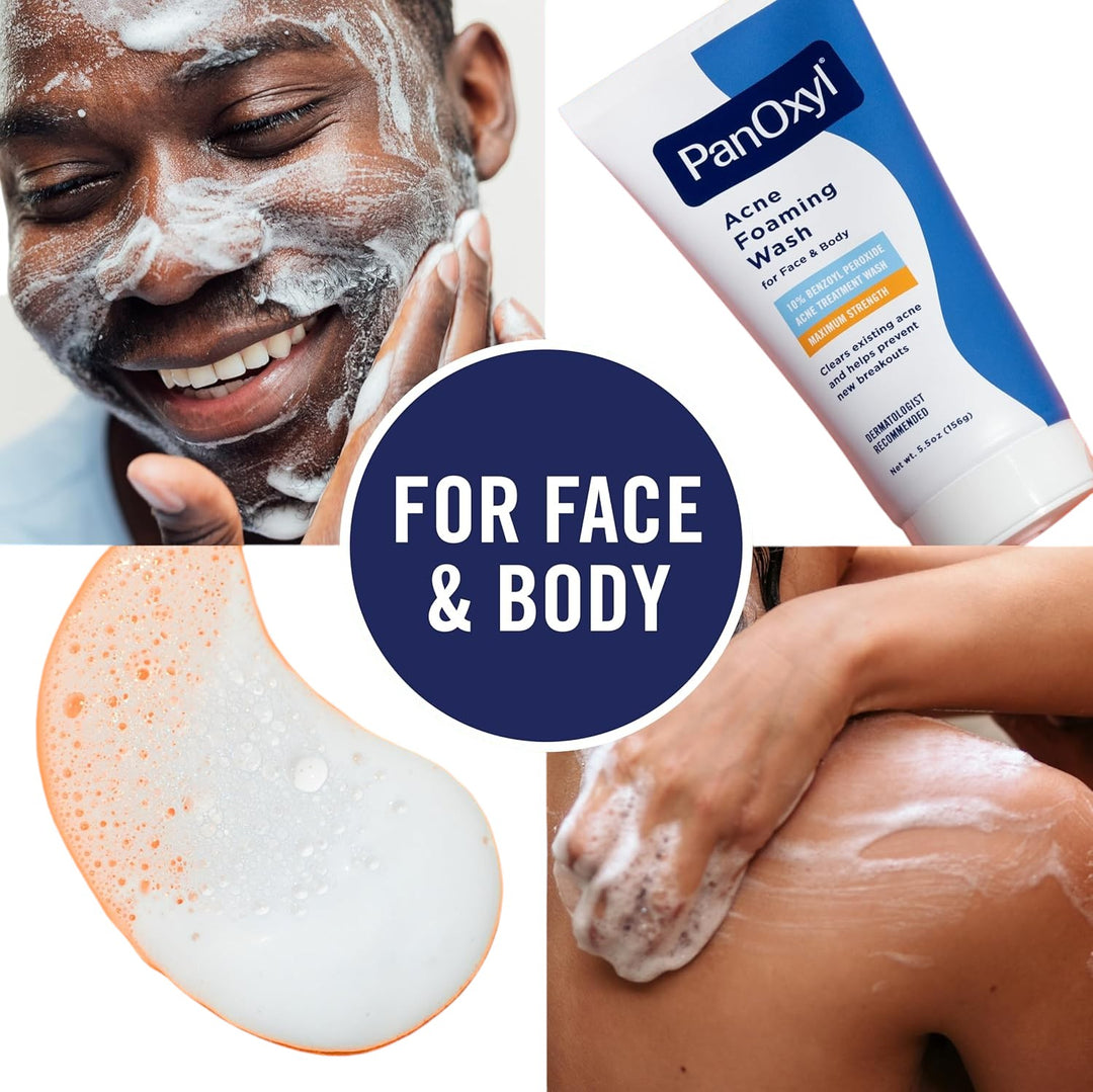 Acne Foaming Wash - GLAM MODA