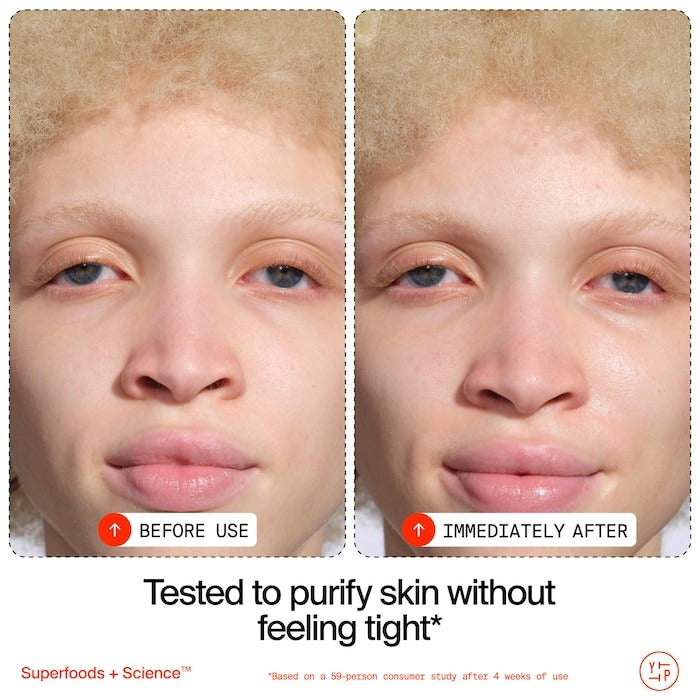 Adaptogens + Snow Mushroom + Oat Oil Lipids + Vitamins Supershroom Calm Cleanser - GLAM MODA