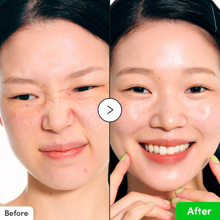 Aloe PDRN Calming Serum - GLAM MODA