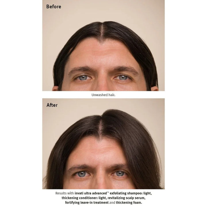 Aveda Invati Ultra Advanced Exfoliating Shampoo - Light 200ml - GLAM MODA