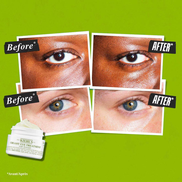 Avocado Eye Cream - GLAM MODA