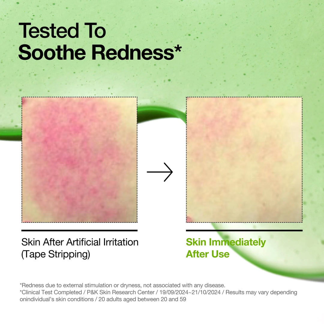 Azelaic Acid 10 Hyaluron Redness Soothing Serum - GLAM MODA