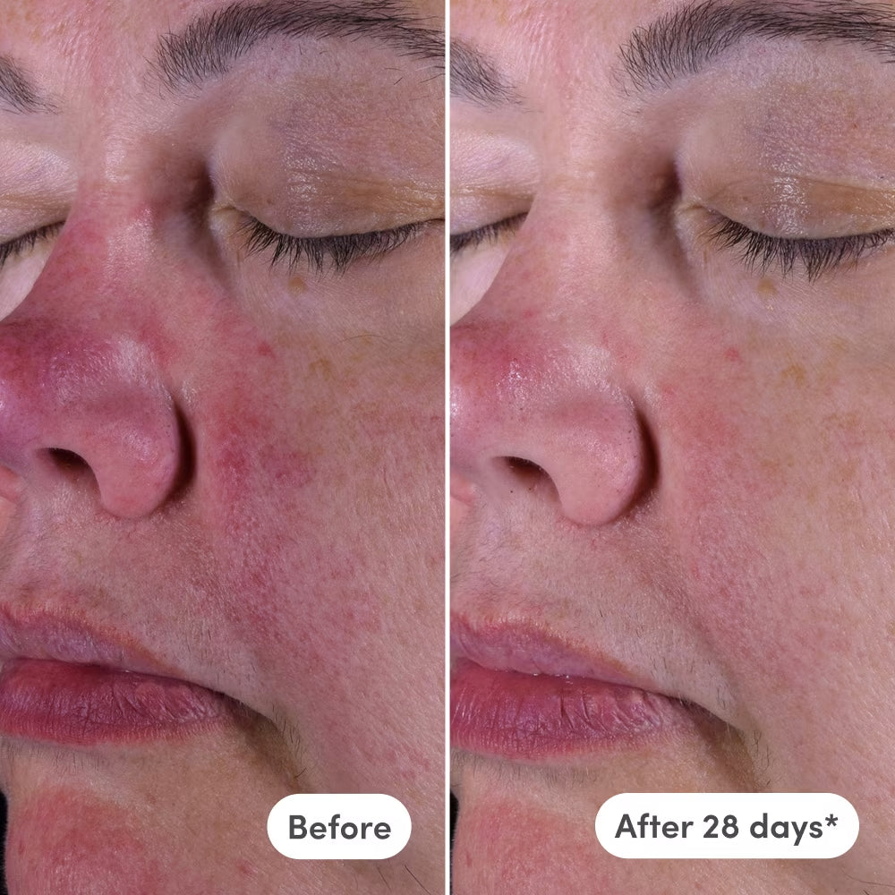 Azelaic Exosome + Vitamin C Serum - Naked Ambition - GLAM MODA