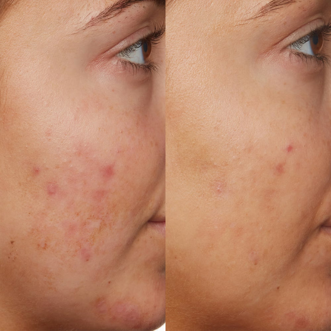 B3 Nice 10% Niacinamide Serum 30ml - GLAM MODA